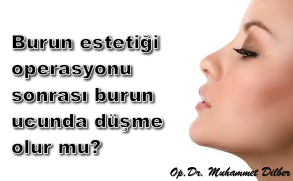 Burun estetiği operasyonu sonrası burun ucunda düşme olur mu?