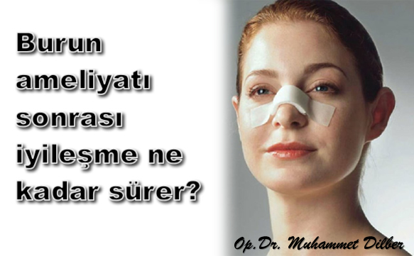 Burun ameliyatı sonrası iyileşme ne kadar sürer?