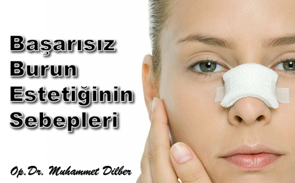Başarısız Burun Estetiğinin Sebepleri Nelerdir?